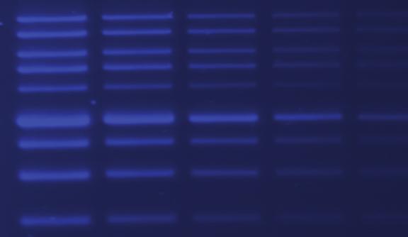 Light Imaging Protein gels stained with Coomassie blue or silver stain can easily be imaged using the visible light application.