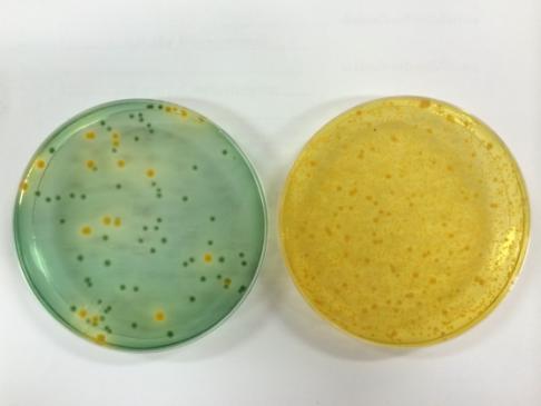 กา PL testing ; healthy HP and less contamination of Vibrio No abnormal HP Green colony