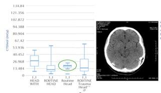 Clinical excellence through Imaging Insights Identify variations and nonstandard protocols; monitor impact and help sustain clinical excellence 41% Brain CT radiation dose can be reduced by 41% while
