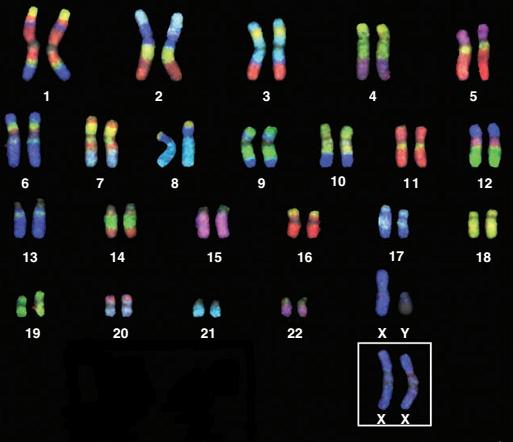 Human Chromosomes Karyotype Humans have 22 pairs of chromosomes that are called autosomes or chromosomes that are NOT