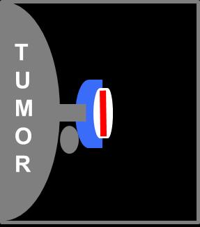 Day -10 Day 0 Day 30 Mutated neo-antigens are drivers of immune response against cancer Tumor growth Control Adjuvant Adjuvant +