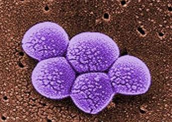 Methicillin resistant staphylococcus aureus (MRSA) A significant challenge due to multidrug-resistance Major cause of severe hospital-acquired infections: - Most common cause of antibiotic resistant