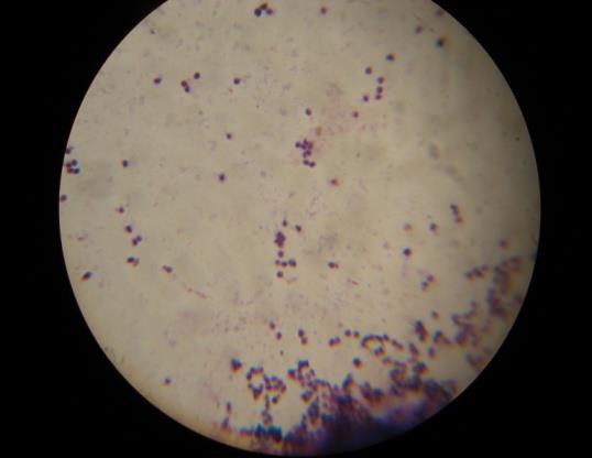 Gram positive isolates were observed by microscopical