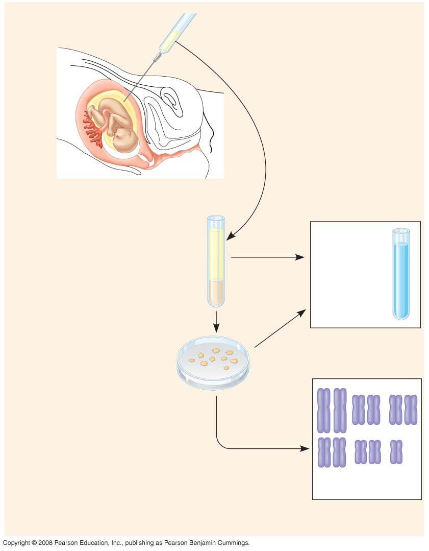 Fig. 4-8a Amniotic fluid withdrawn Fetus Centrifugation Placenta Uterus Cervix Fluid Fetal