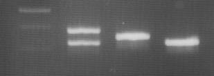 After PCR, the PCR products was applied to DNA 1000 LabChip Kit, and analyzed with Agilent 2100 bioanalyzer.