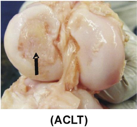 Immediate ACL repair Collagen scaffold PRP Suture
