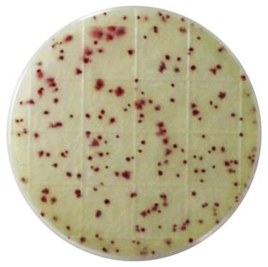Analysis of Results At the end of incubation period, observe plates for red/purple colonies as viewed through the clear side of plate.