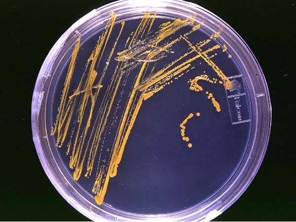 Saccharomyces Growth Liquid Media (Cultures) Solid Media (Plates) Both made