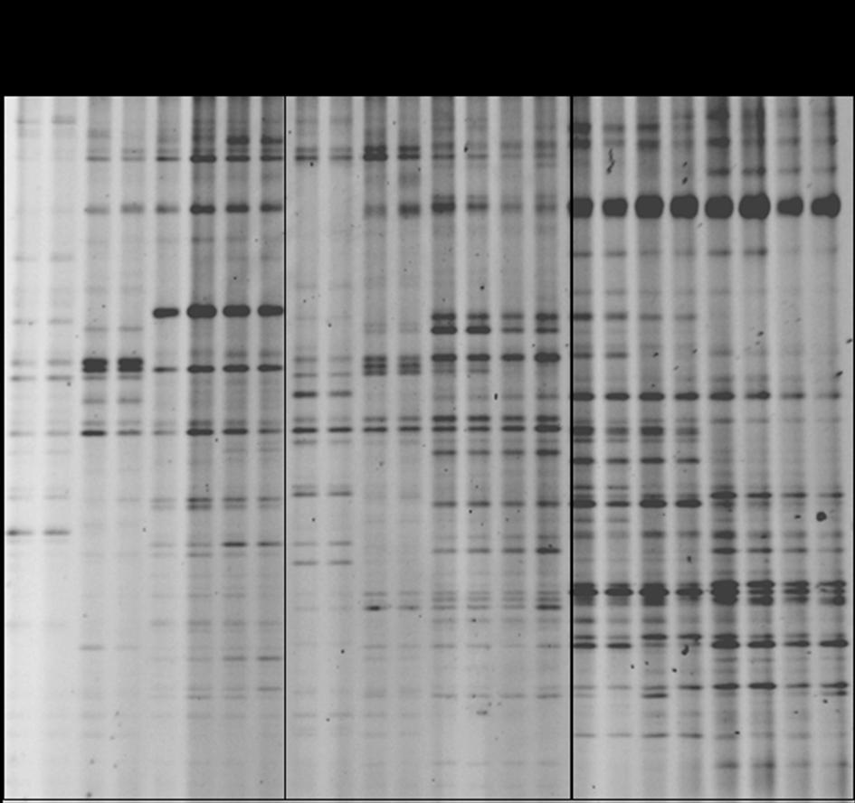 36 Slika 8: Profili DGGE delnih zaporedij gena za 16S rrna bakterij v bioreaktorjih z dodatkom diazepama (X1, X2) in kontrolnem bioreaktorju (R0) tekom enoletnega obratovanja.
