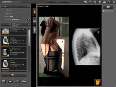 This allows Image Suite to receive patient and exam information electronically.