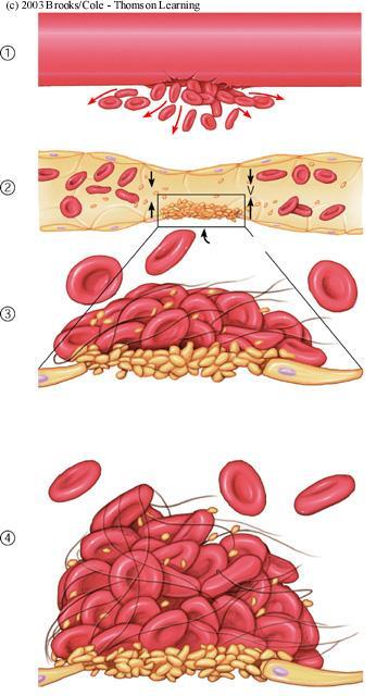Formation of platelet aggregate Injured blood vessel releases ADP, which attracts platelets (PLT) PLT comming in contact with