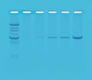 Biotech Basics EDVOTEK WORKSOP Module III: Analyzing PCR Products using Agarose Gel Electrophoresis Excerpts from Kit 13 1. 2. 3. 5x 1: Wear gloves and safety goggles Concentrated buffer 4. 5. 6 C 6 C Flask Distilled water 6.