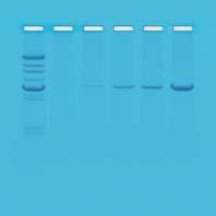 EDVOTEK WORKSOP Biotech Basics Module III: Analyzing PCR Products using Agarose Gel Electrophoresis Excerpts from Kit 13 8. 9.