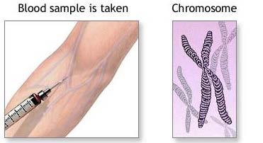 This test can: Count the number of chromosomes Look for structural changes in chromosomes The test can be performed