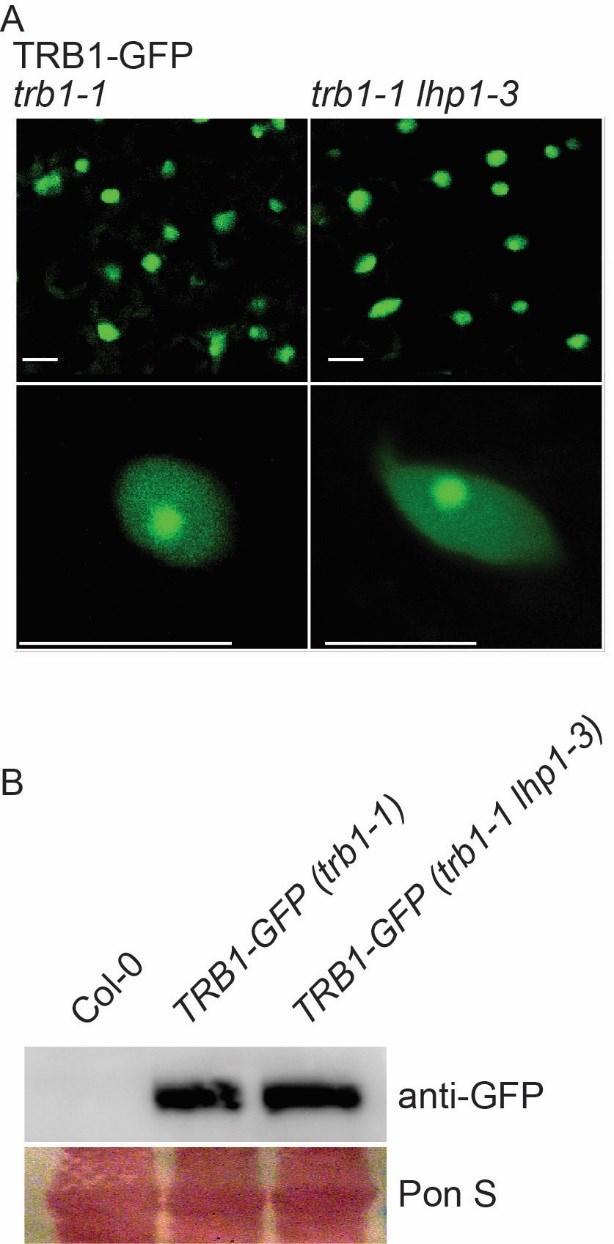 Supplemental Figure 10. TRB1-GFP localization and level in trb1-1 and lhp1.