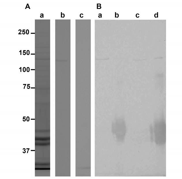 Fig. S11 DEAE Sephacel fraction containing the BY-2 myosin VIII-1 and immuno-precipitation with the anti-atm1 antibody.