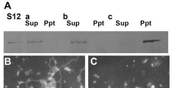 Fig. S13 The immno-depletion of 175-kD myosin with the anti-bm175 peptide antibody from the S12 fraction.