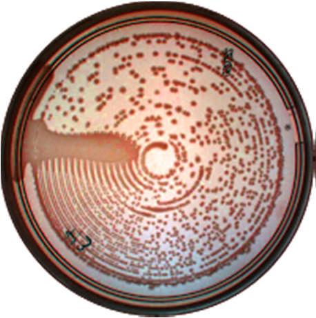 Sample is spread on the petridish radius in streaked in a spiral pattern to