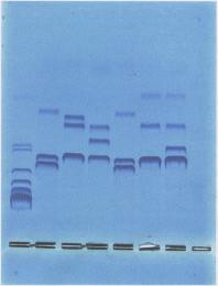 Picture 1 - showing results of gel electrophoresis (a) and interpretation of these results in terms of Otter populations (b). Each coloured circle corresponds with one individual otter.