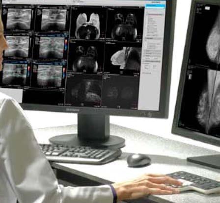 The Integral Breast addresses the need for integrated image and information management and takes it a step further by seamlessly interfacing advanced processing capabilities for Digital Mammography,
