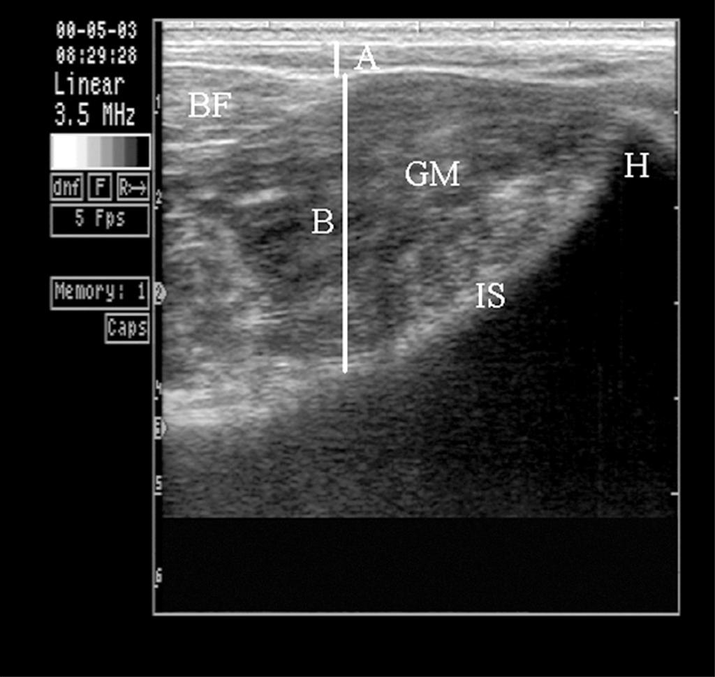1354 Tait et al. Figure 1. Classic scanner 200 (Classic Medical Co., Tequesta, FL) longitudinal ultrasound image collected over the rump of the animal.
