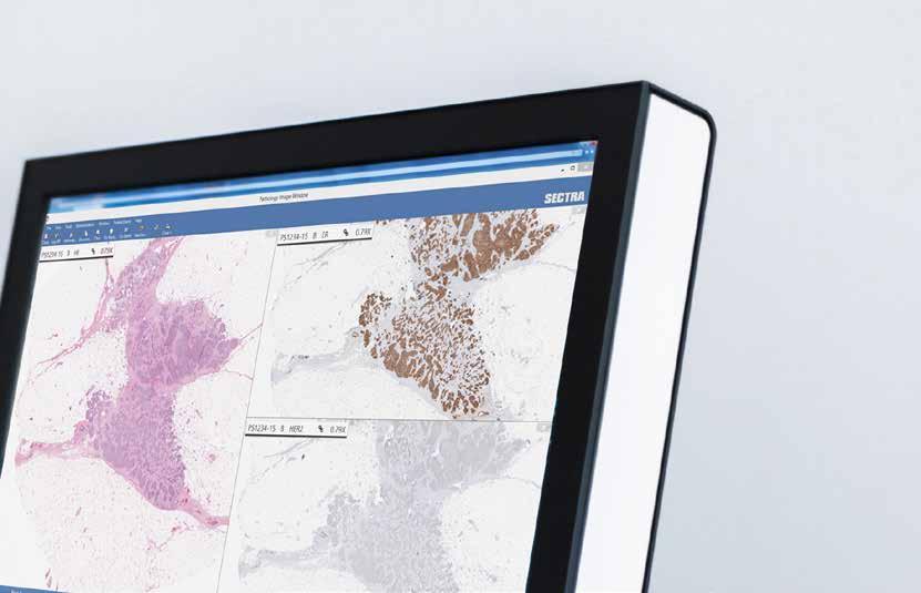 Sectra digital pathology Solution overview Sectra provides a complete solution for primary diagnostics in pathology, developed in close cooperation with leading practitioners.