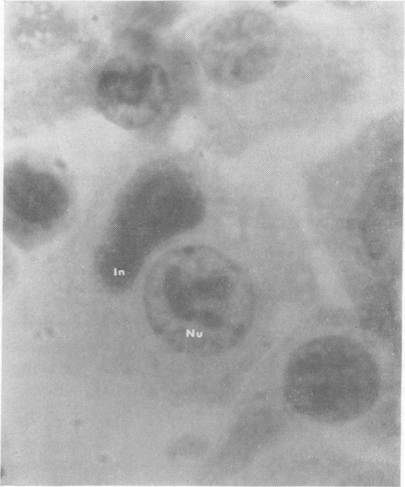 Gordon and A. L. Quan, Bacteriol. Proc., p. 148, 1962).
