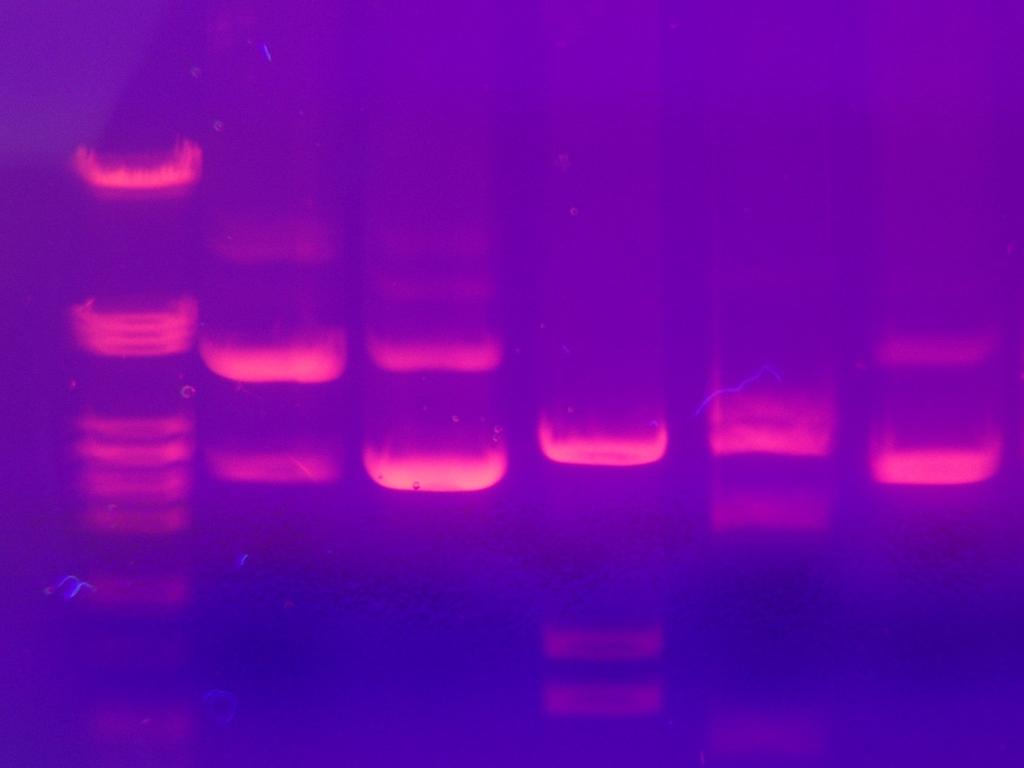 DNA fragments from each other 2.