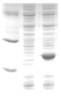 kits for protein purification Sample type Bacteria sample In vitro expression sample Eukaryotic sample Available kit His-tagged Protein Purification Kit Cell-Based Protein Purification Kit Purify