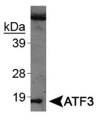 Images Western Blot: ATF3 Antibody [NBP1-02935] - Western blot analysis of ATF3 on UV treated NIH/3T3 cell extracts using NBP1-02935. Page 2 of 5 v.20.