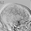Comprehensive diagnostic and treatment support for ischemic stroke patients Decide Identify if the patient has an ischemic or hemorrhagic stroke, locate the affected area and assess the state of the