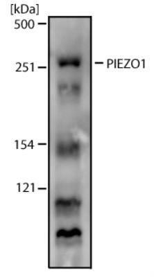 Images Western Blot: PIEZO1 Antibody [NBP1-78537] - Analysis of MCF7 cell lysate using PIEZ01 antibody (NBP1-78537) at 2 ug/ml. Page 2 of 5 v.20.