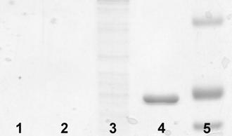 coli lysate overexpressing GFP-TEV-HA-GST; lane 4: 8μg GST-a1; lane 5: Molecular weight marker.