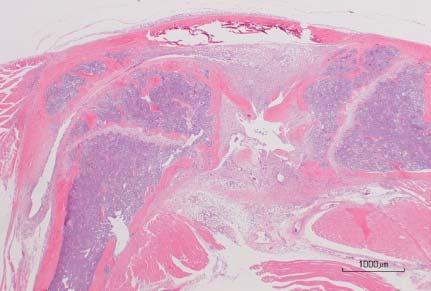 synovial cell Degeneration, joint cartilage Fibrosis