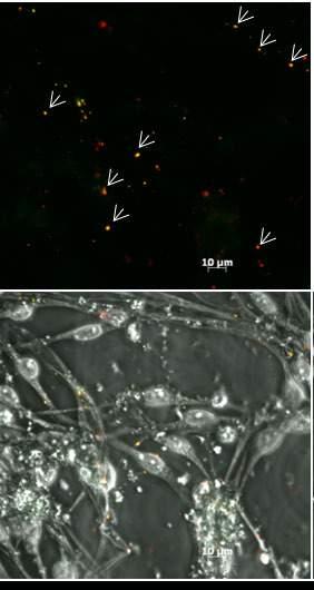 Results Cells grown on softer surfaces form functional synapses (red: synaptophysin,