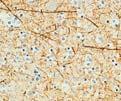 Datasheet and Instructions for Use Summary and Explanation: Antigen detection, in tissues and cells, is a multi-step immunohistochemical process.
