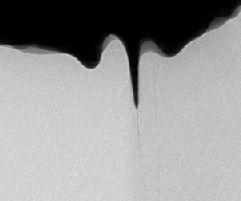 mm from the sample Sample 100µm X-ray microradiograph (ID19, 18