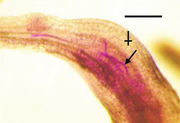 1). At 5 DAI, the root tissues of the nematode infection sites were
