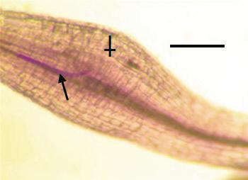 In microscopic examination, thread-like nematodes were mostly found in