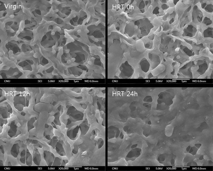 Determination of Optimal HRT of the Anaerobic SHT SEM images