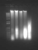 0) Analyzing DNA samples With gel electrophoresis Analyzing DNA samples With gel