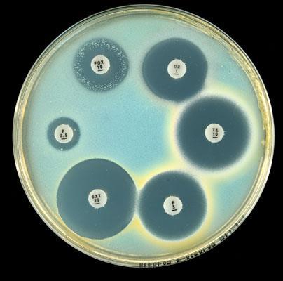 Oxacillin-susceptible mec-a positive Staphylococcus aureus Non multi-resistant MRSA with a heterogeneous resistance to