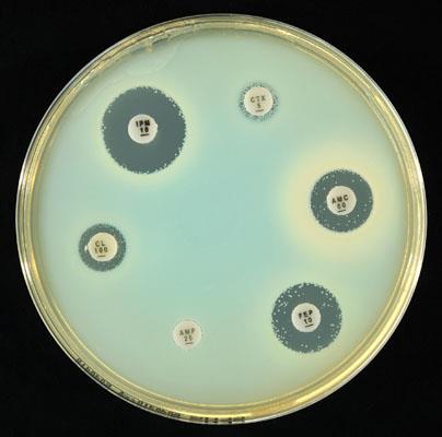 E. coli: R/AMP 25, AMC 60, CTX 5, CL100 and FEP 10, colonies at the edge of imipenem zone (> 6 mm).