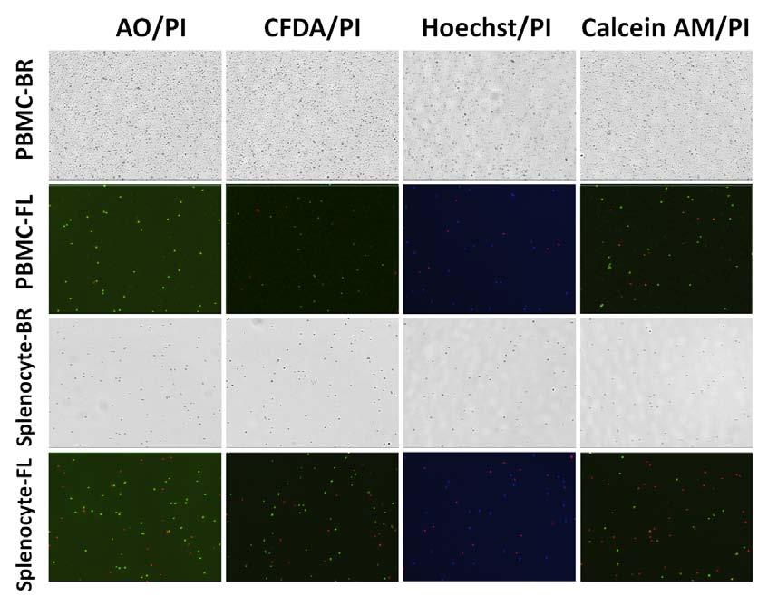 Figure 4. Dual-staining Method for Primary Splenocytes and PBMCs Viabilities of primary splenocytes and PBMCs were analyzed using: AO/PI, Hoechst/PI, Calcein AM/PI, and CFDA/PI.