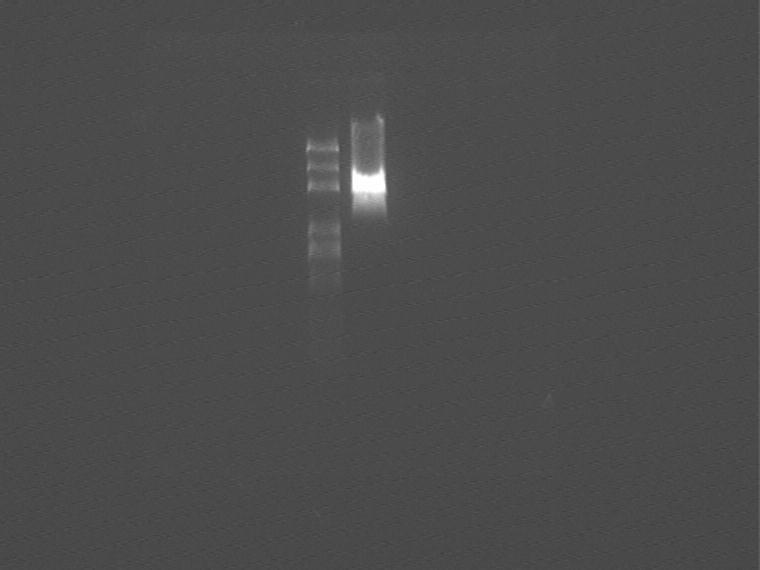 Figure 2 0811 Pick up nine colonies from the plate and PCR to check the results (Fig 1) As shown in Fig 1, 5.1-5.6 are all achromatic, but electrophoresis results show that they are self-ligation.