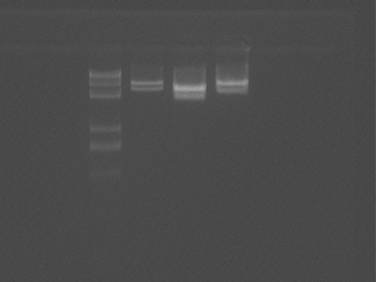 Figure 1 0812 Double enzyme digestion 5.7~5.9 plasmid, electrophoresis (Fig 1). It seems that only 5.