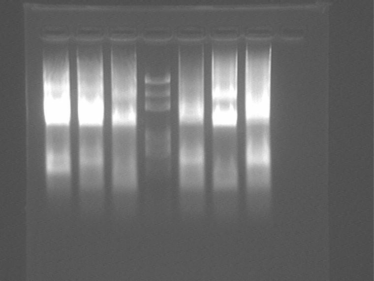 Figure 2 0813 Use dlva primer to PCR plamid 5(no GFP), enzyme