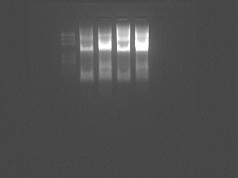it with GFP vector. Use dlva primer to PCR plasmid 5.7 and 5.