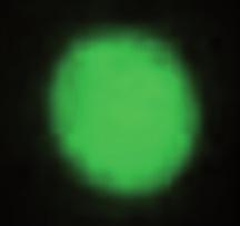 The focal plane within the cell is scanned with a laser 11, and the spatial distribution 12 of fluorescence and reflected light on the focal plane is recorded.