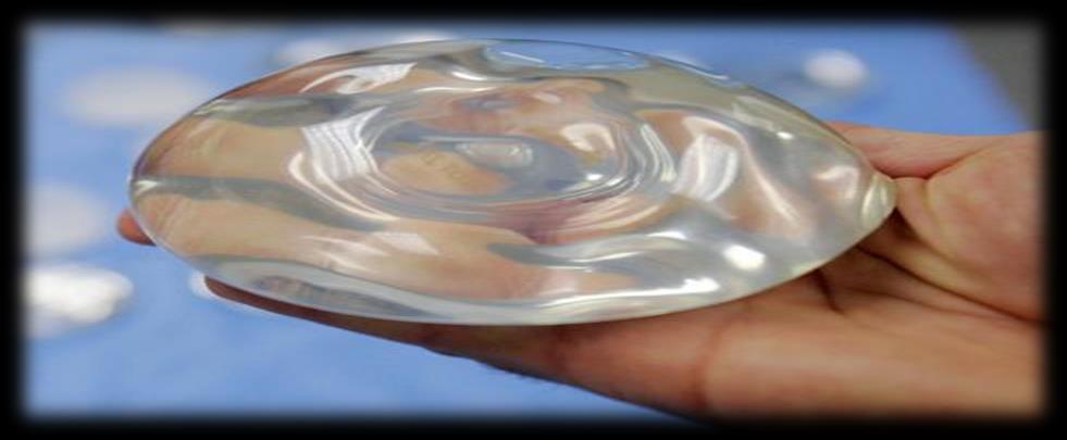 Global Silicone Gel Market: Analysis By End-User Industry, By Sub- Sector, By Region, By Country: Trends,